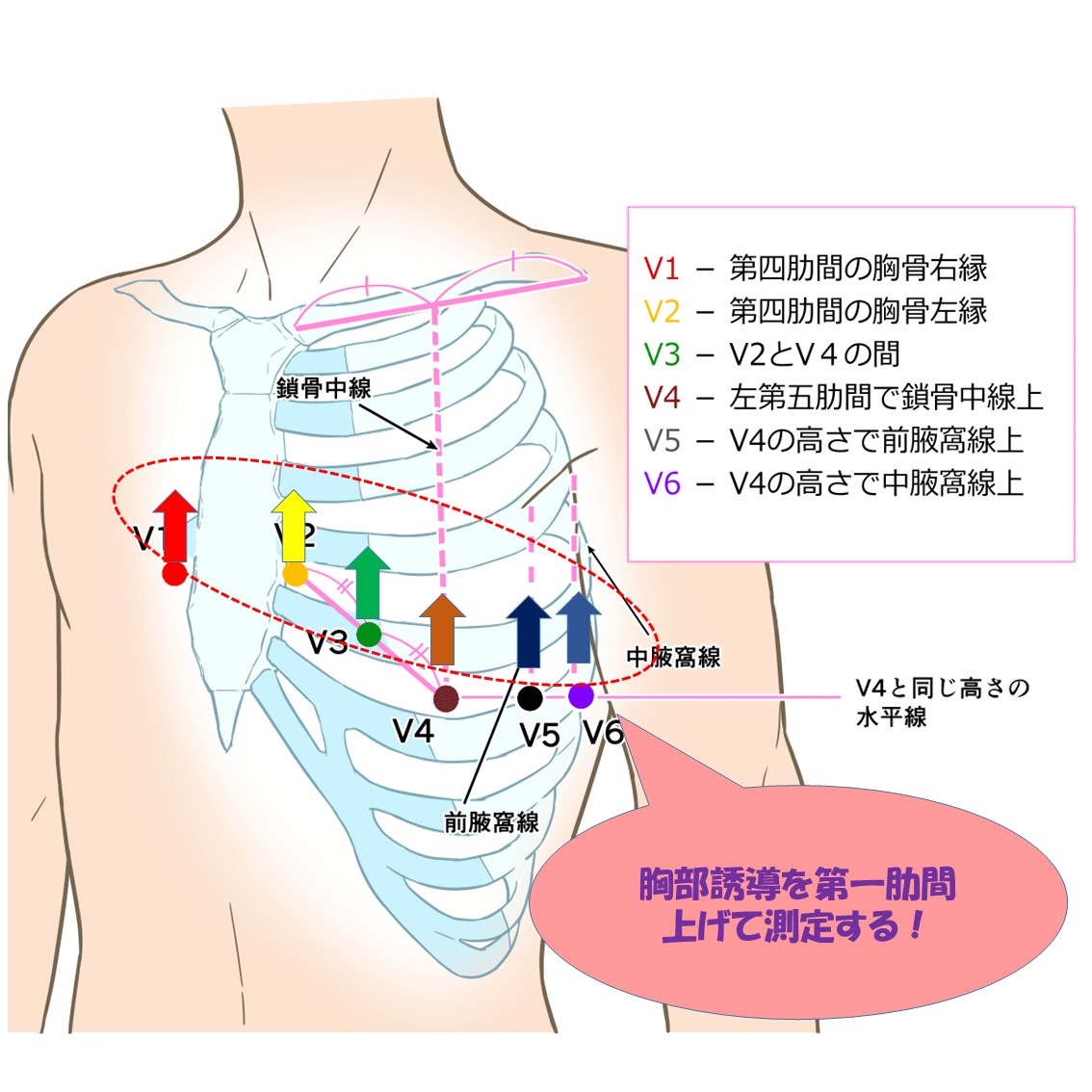 ER心電図の超速診断 カラー 救急現場で初心者から役立つ 健康・医学